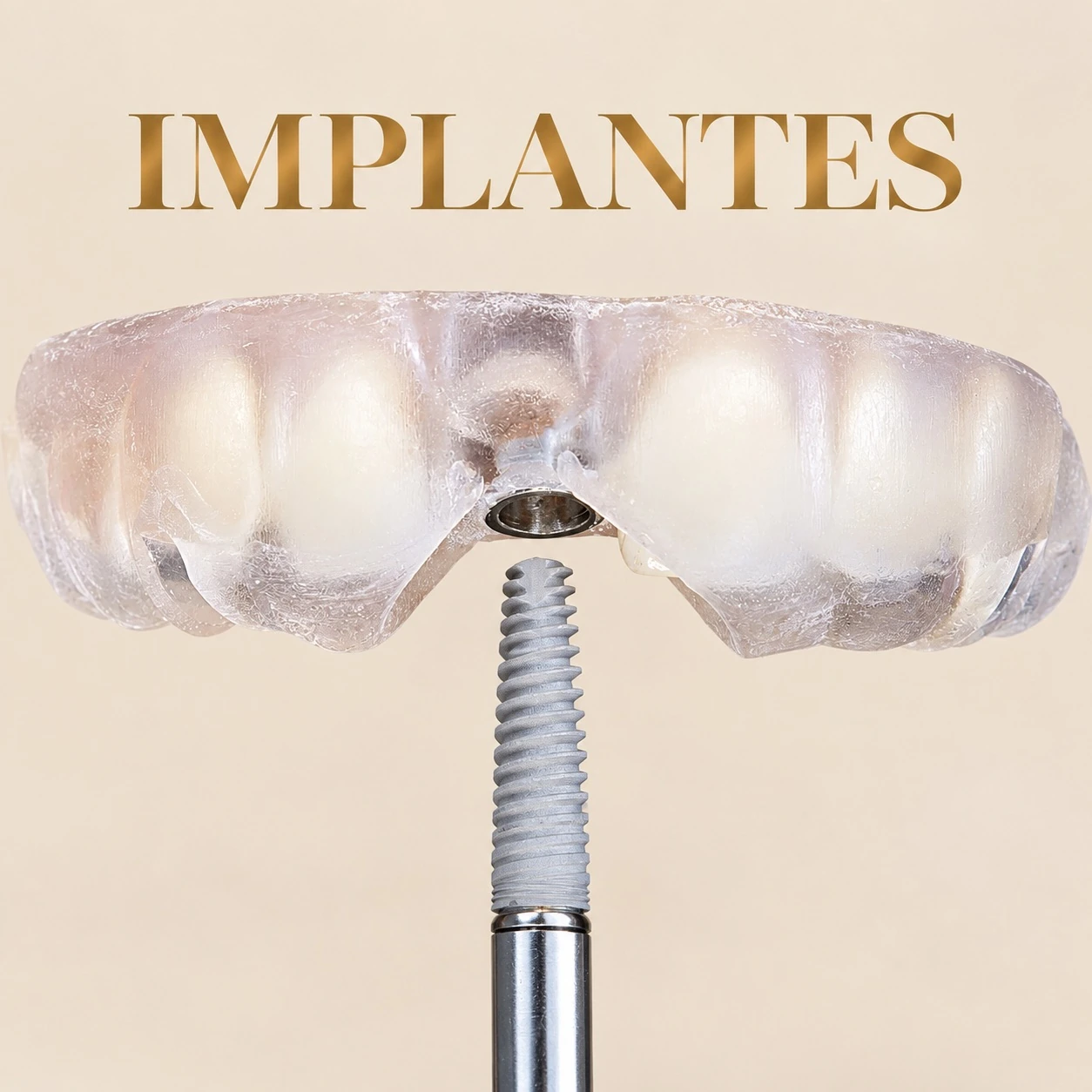 Implantes dentales
